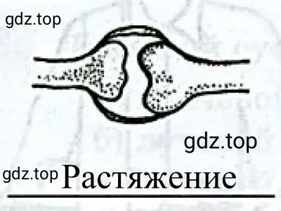 Рисунок 4. Растяжение суставов