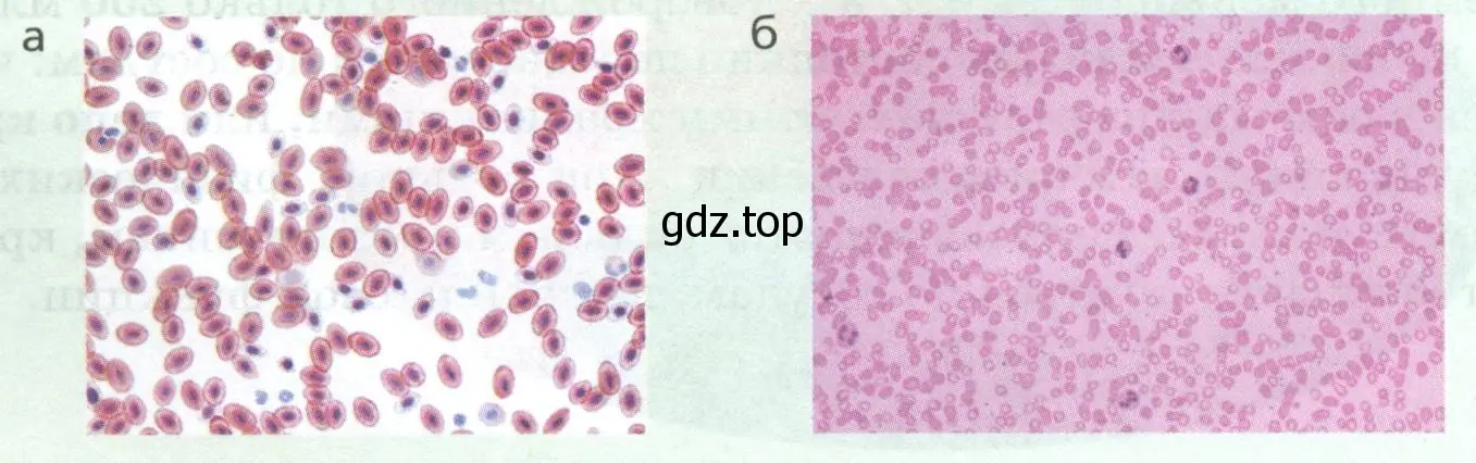 Клетки крови: лягушки (а), человека (б)