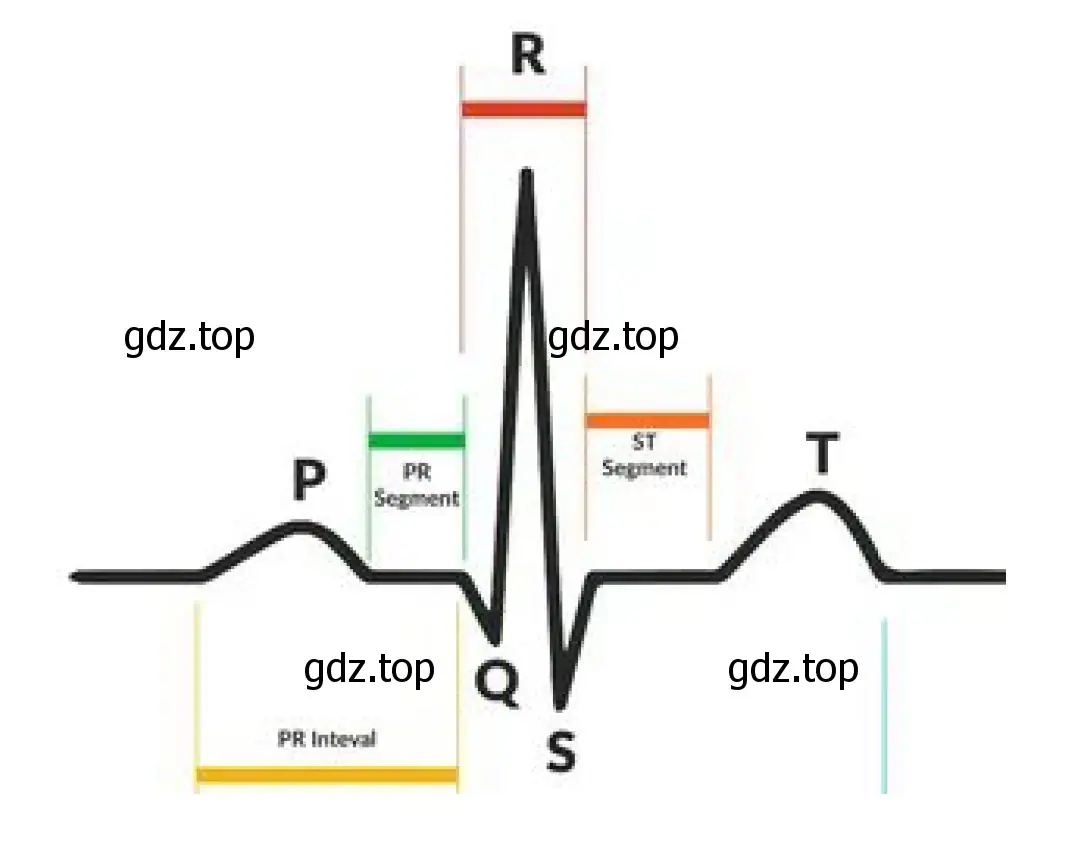 ЭКГ с комплексами Р, QRS и Т