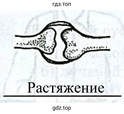 Рисунок 4. Растяжение суставов