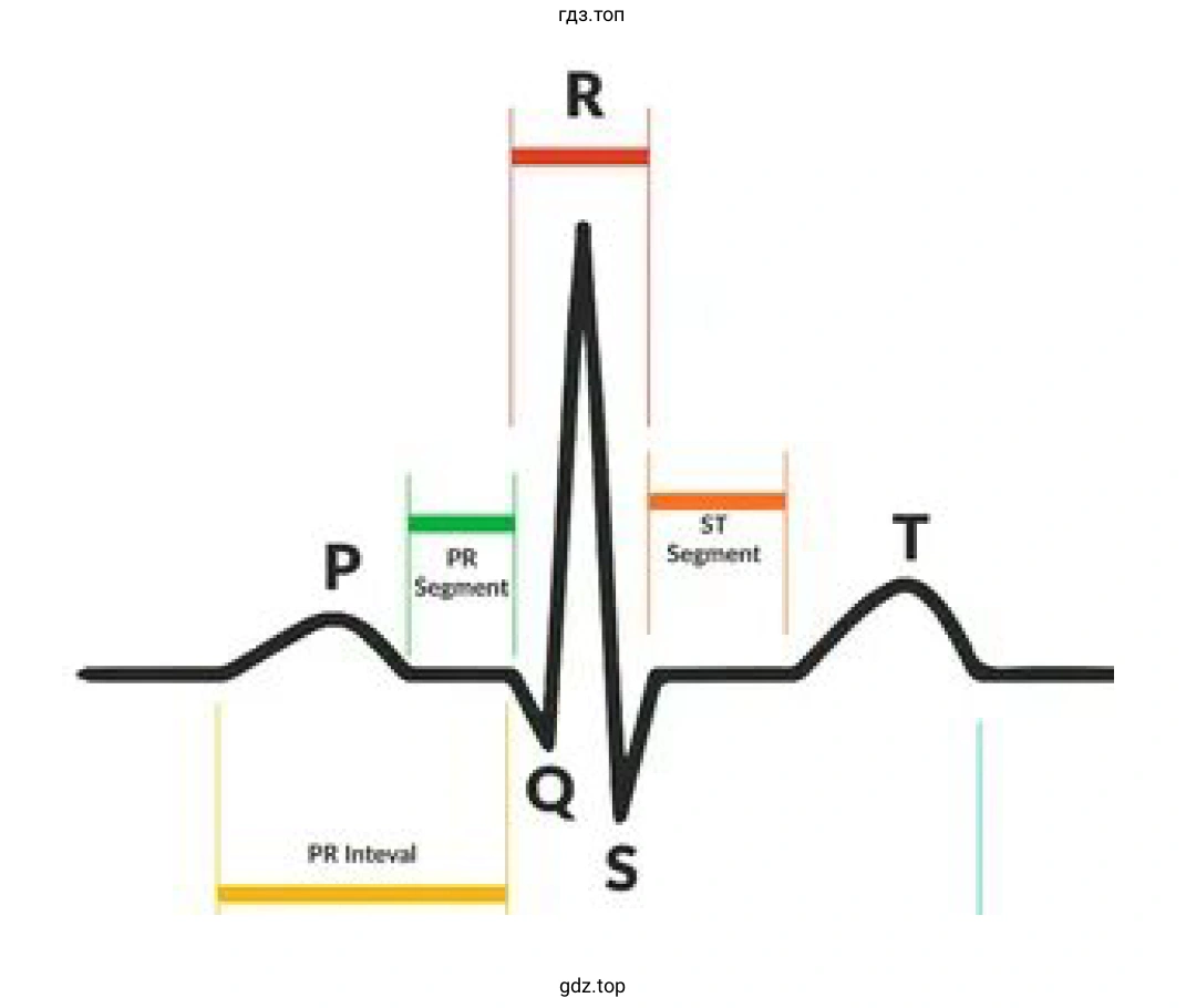 ЭКГ с комплексами Р, QRS и Т